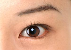 子宮頸がんは自分でも検査出来る